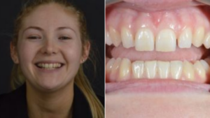 Cherrybank Dental Transformations: Charlotte McGregor