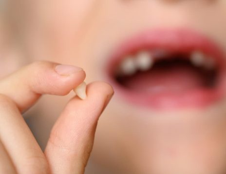 Common Dental Emergencies and How Dentists Treat Them